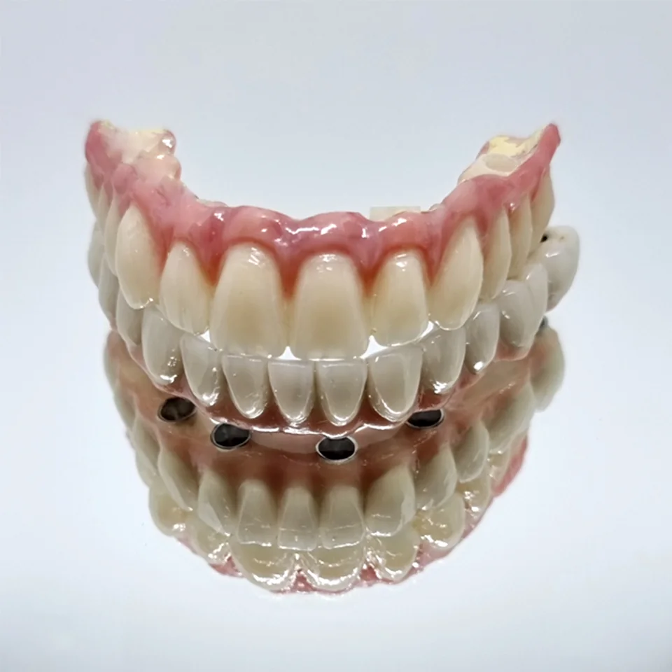 Protesi dentale completa con denti e gengiva artificiale su superficie riflettente